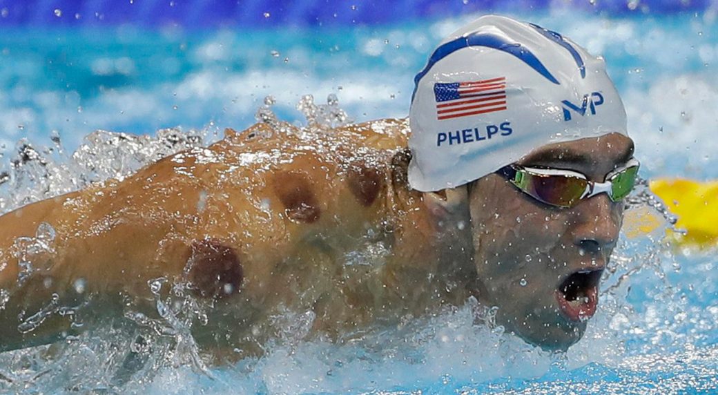 Coppettazione Michael Phelps
